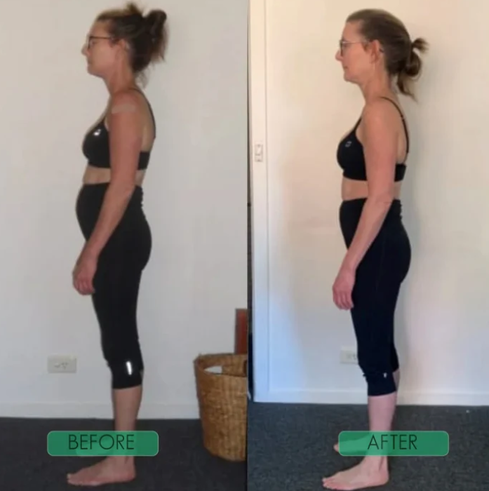 Natura - Posture Support Straps